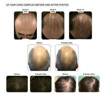 Load image into Gallery viewer, Grofactor Hair System, 4ml
