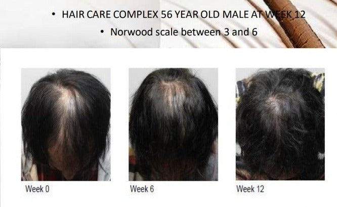 Grofactor Hair System (4ml) Skinluv.in