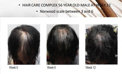 Grofactor Hair System (4ml) Skinluv.in