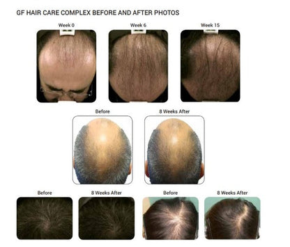 Grofactor Hair System (4ml) Skinluv.in